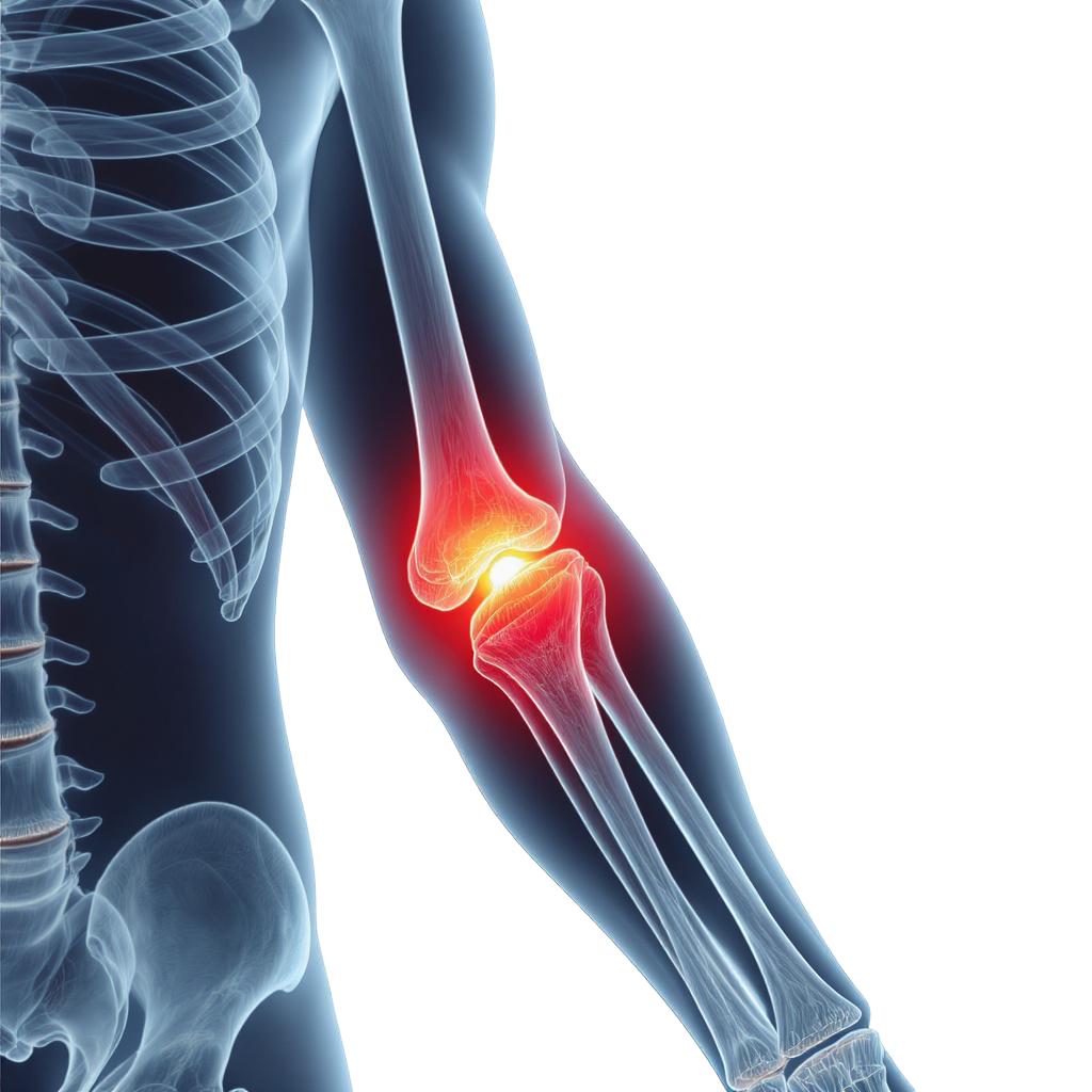 Tennisarm, Karpaltunnelsyndrom und Ellbogenschmerzen behandeln mit FDM Physiotherapie Wienerwald